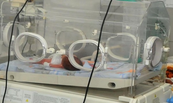 Мексико потвърди за новородено починало заради зика