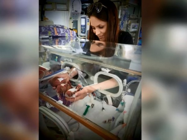 Британски лекари успяха да спасят най-малките новородени близнаци. Двете момчета