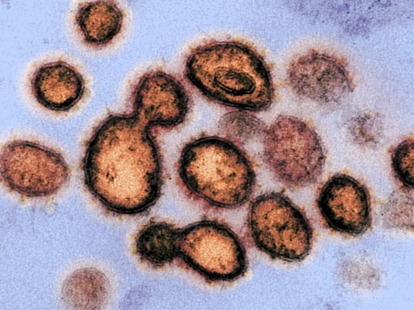 Коронавирусът, който причинява COVID-19, може да се задържи във въздуха