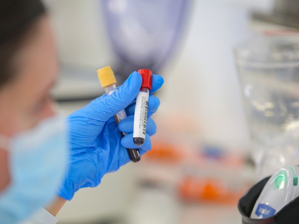 Потвърдена е положителната проба за коронавирус на 43-годишен пациент в