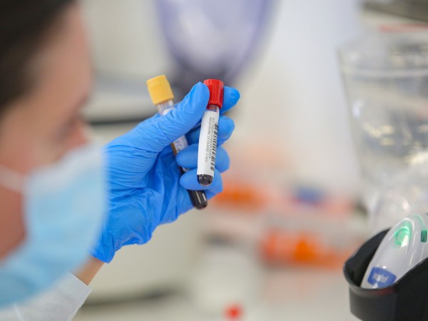 Четири са доказаните нови случаи на коронавирус в Бургаско. Един