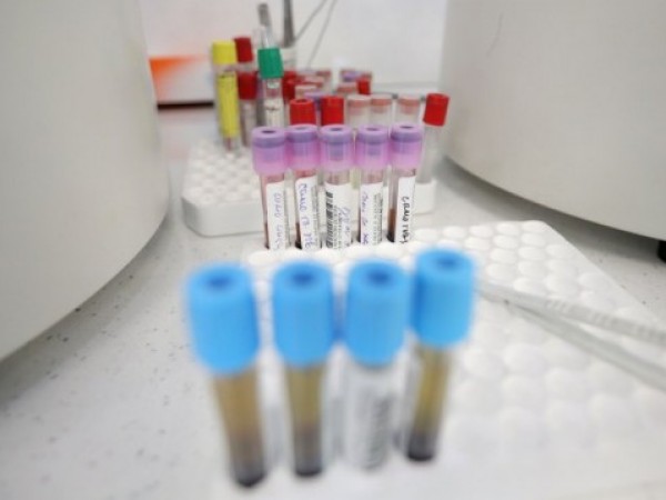 Четири са новите случаи на заразени с COVID-19 в Кюстендил,