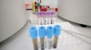 Четири са новите случаи на заразени с COVID 19 в Кюстендил