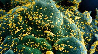 Тежките случаи на протичане на коронавирусната инфекция са свързани с