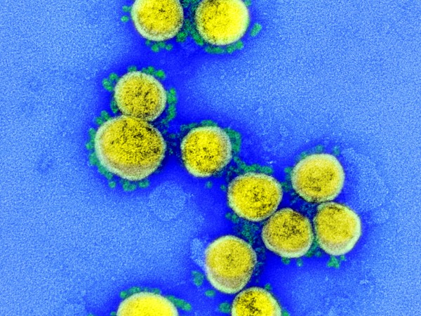 Експериментална ваксина защитава макаци от зараза с коронавирус САРС-Ков-2, съобщиха