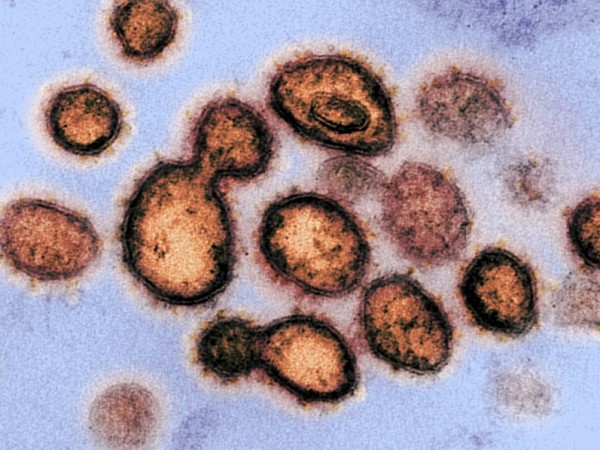 Проникне ли веднъж в човешкия организъм, коронавирусът напада не само