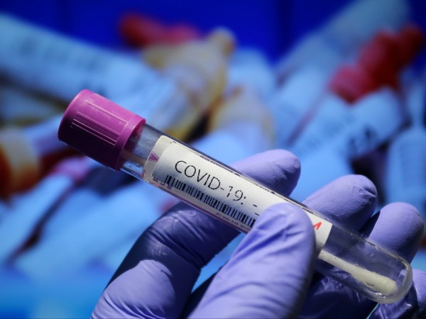 Нови 36 случая на коронавирус са регистрирани у нас, 11
