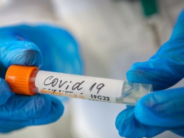 Новите случаи с коронавирус за денонощието у нас са 17.