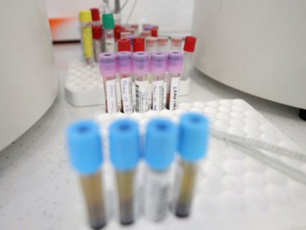 2593 са потвърдените случаи на коронавирус в България. Това сочат