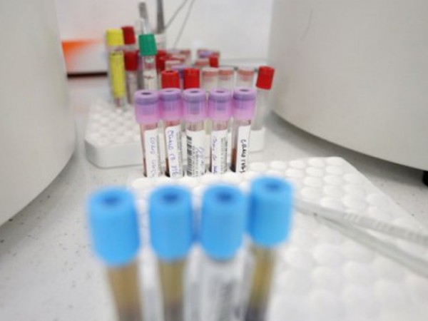 Девет нови случая на заразени с коронавирус са установени в
