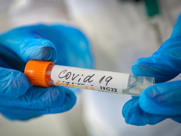 Шестгодишно дете е с положителен тест за коронавирус в Сливенско