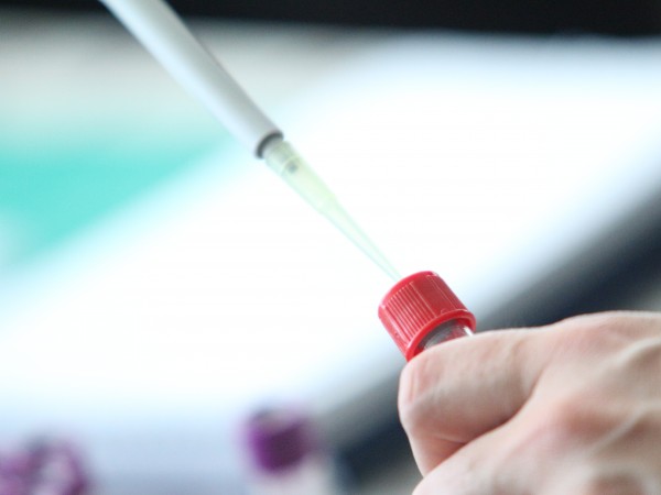 10 души с положителни тестове за новия коронавирус са регистрирани
