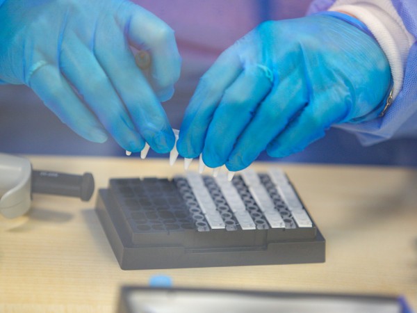 Министерството на здравеопазването ще закупи 22 000 Real-time PCR теста
