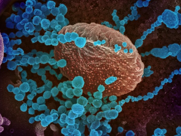 Коронавирусът може да започне да живее постоянно в човешкото тяло,