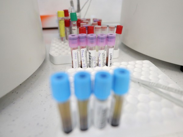 Десет нови случая на коронавирус са регистрирани във Великотърновска област,