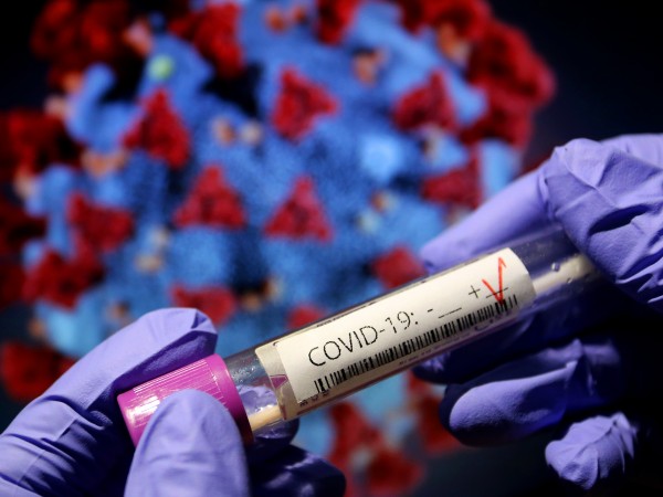 330 са новите случаи на коронавирус у нас за последното