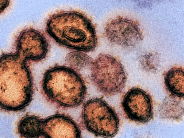 Световната здравна организация отчете рекордно увеличаване на новозаразените с коронавирус