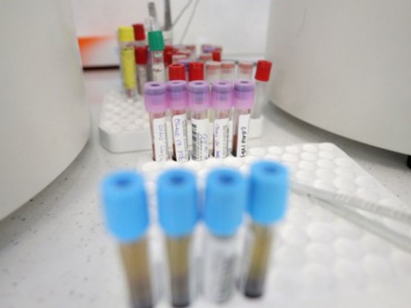 Да бъдат създадени спешни пунктове за тестване за коронавирус настояват