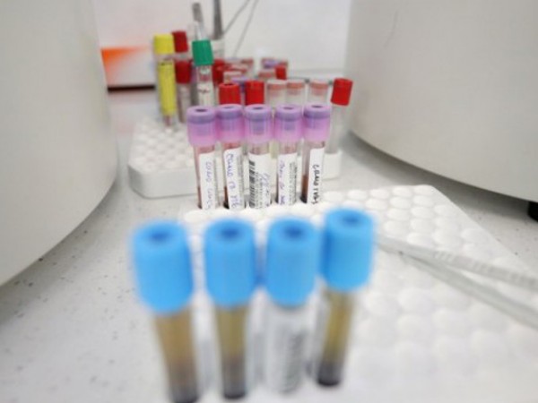Десет нови случая на коронавирус са регистрирани за последното денонощие