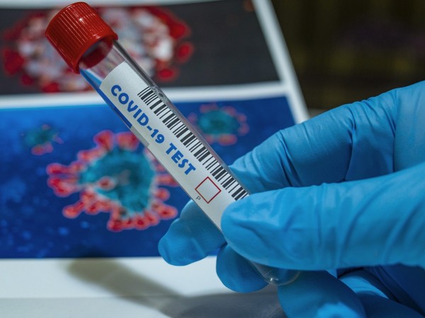 Двама мъже са новите случаи на заразени с коронавирус в