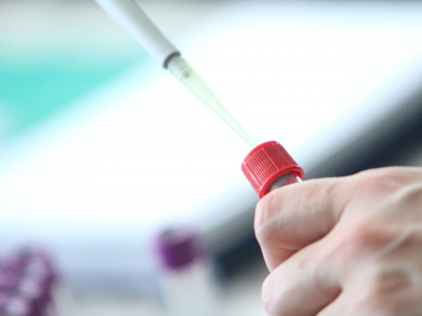 303 са новите случаи на заразени с коронавирус в България
