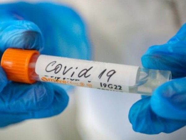 Броят на заразените с коронавирус в света надвърли 19 милиона