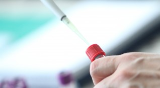134 са положителните проби за коронавирус при извършени 3612 PCR