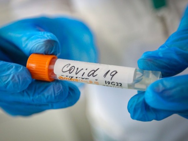 171 са новите случаи на коронавирус у нас за последното