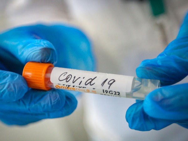 Германия и Франция отчетоха най-високия ръст на инфекции от коронавирус