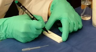 Шестима от заразените с коронавирус през последното денонощие в Ямболска