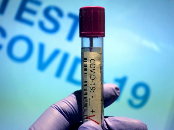 16 души с коронавирус са починали през последното денонощие, отчита