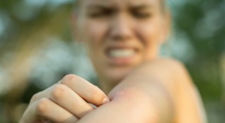 Ухапванията от насекоми предизвикват истинска вълна от неприятни симптоми