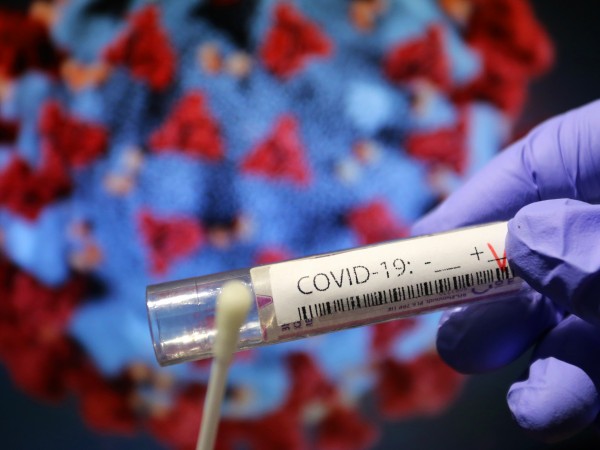 44 са новите доказани случаи на заразени с коронавирус през