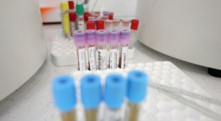 160 са новите случаи на коронавирус у нас при изследвани