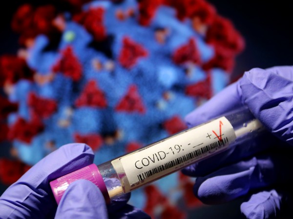 263 са новите положителни проби за коронавирус през изминалите 24