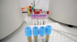 Не се налага затягане на мерките срещу коронавируса нито нови