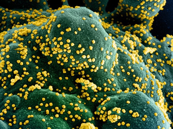 Коронавирусът може да оцелее до 28 дни - много по-дълго