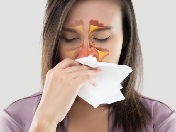 Настинка, грип, алергии, синузит са често срещани причини за появата