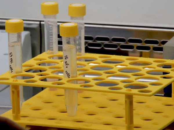 Доброволец получи първата тестова доза на турската ваксина срещу COVID-19.