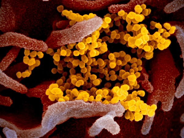 На фона на развихрилата се епидемия от коронавирус учените предупреждават