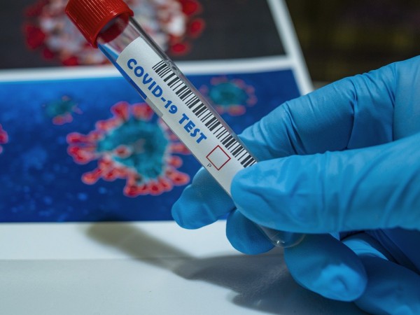 67 проби за коронавирус са положителни след направени антигенни тестове