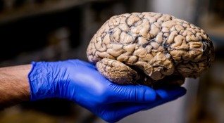 Невролози съобщават за увеличаване на броя на пациентите с оплаквания
