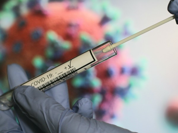Жена на 35 години е сред починалите с коронавирус у