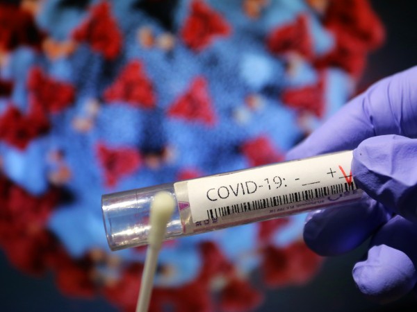 577 са новите доказани случаи на заразени с коронавирус през