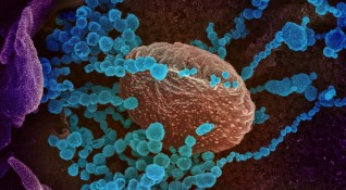 Учени са установили че коронавирусът може да предизвика рядка инфекция