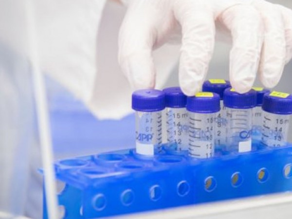 570 са новите регистрирани случаи на коронавирус у нас при