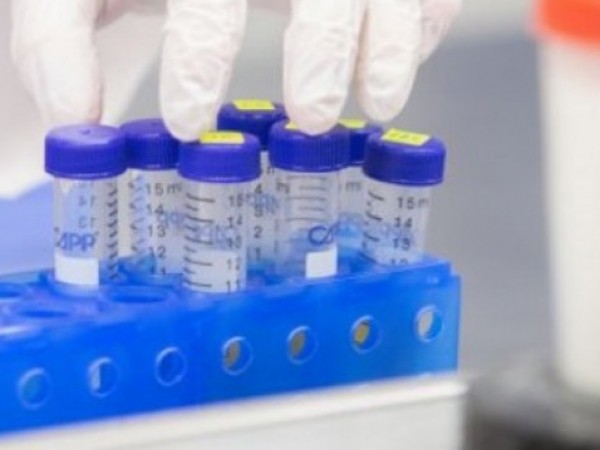 PCR тестовете не улавят новата мутация на Ковид-19. Колко по-страшна