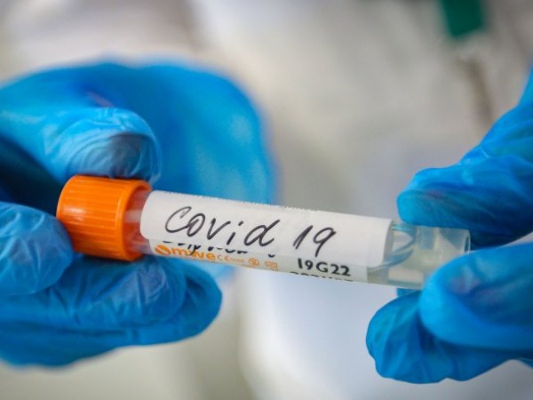 Близо 106 милиона са заразените с коронавирус по света. Почти