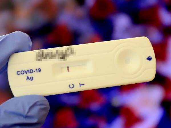 Потвърдени са 24 случаи на коронавирусна инфекция в област Добрич