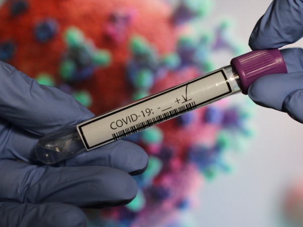 Огнище на коронавирус е регистрирано от здравните власти в защитеното